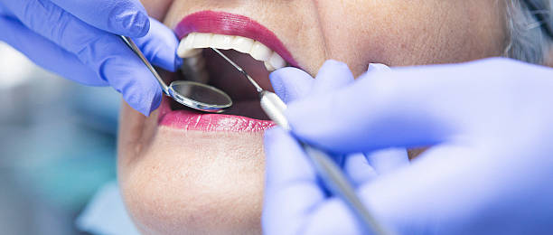 Best Holiday Emergency Dentist in Taylorvle, IL